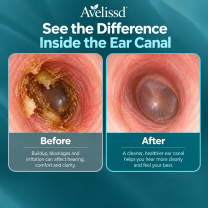 Earase Ear Drops